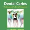 Dental Caries
