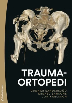 Traumaortopedi